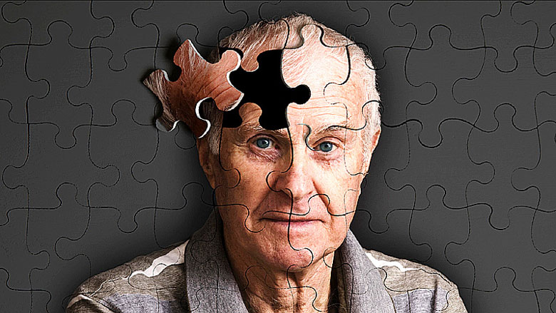 بیماری آلزایمر چیست؟